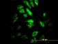 PSMB10 Antibody (monoclonal) (M01)